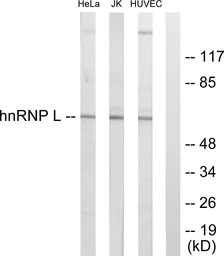 Anti-hnRNP L antibody used in Western Blot (WB). GTX87723