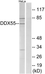 Anti-DDX55 antibody used in Western Blot (WB). GTX87724