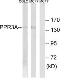 Anti-PPP1R3A antibody used in Western Blot (WB). GTX87725