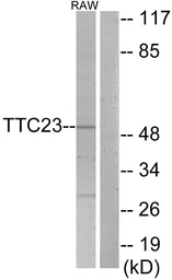 Anti-TTC23 antibody used in Western Blot (WB). GTX87729