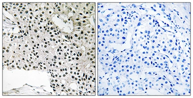 Anti-TCEAL4 antibody used in IHC (Paraffin sections) (IHC-P). GTX87730