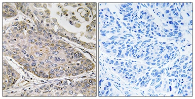 Anti-PLA2G4E antibody used in IHC (Paraffin sections) (IHC-P). GTX87732