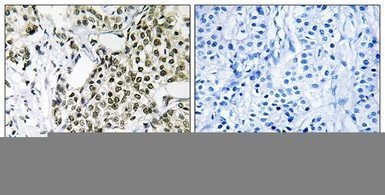 Anti-CAGE1 antibody used in IHC (Paraffin sections) (IHC-P). GTX87737