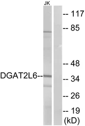 Anti-DGAT2L6 antibody used in Western Blot (WB). GTX87738