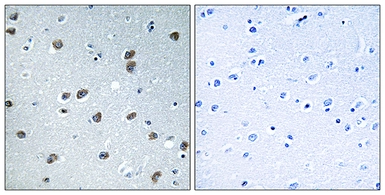 Anti-KLHL29 antibody used in IHC (Paraffin sections) (IHC-P). GTX87752