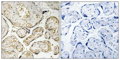 Anti-APOBEC3D + APOBEC3F antibody used in IHC (Paraffin sections) (IHC-P). GTX87757