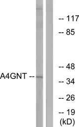 Anti-A4GNT antibody used in Western Blot (WB). GTX87765
