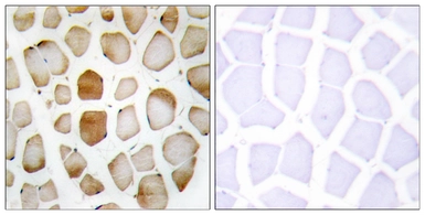 Anti-ATG4B antibody used in IHC (Paraffin sections) (IHC-P). GTX87767