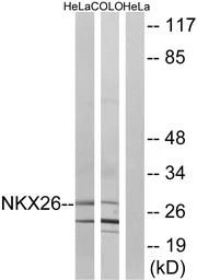 Anti-Nkx2.6 antibody used in Western Blot (WB). GTX87769