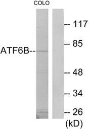 Anti-ATF6B antibody used in Western Blot (WB). GTX87772