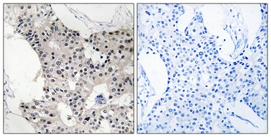Anti-BAGE4 antibody used in IHC (Paraffin sections) (IHC-P). GTX87778