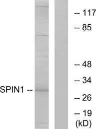 Anti-SPIN1 antibody used in Western Blot (WB). GTX87781
