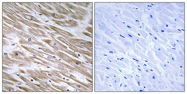 Anti-KANK2 antibody used in IHC (Paraffin sections) (IHC-P). GTX87782