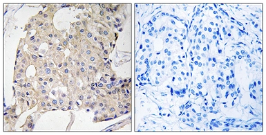 Anti-NDRG3 antibody used in IHC (Paraffin sections) (IHC-P). GTX87787