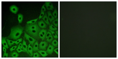 Anti-GPR153 antibody used in Immunocytochemistry/ Immunofluorescence (ICC/IF). GTX87792