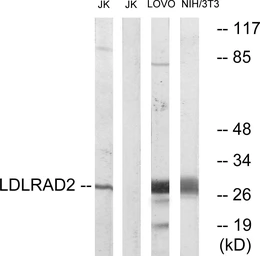 Anti-LDLRAD2 antibody used in Western Blot (WB). GTX87793