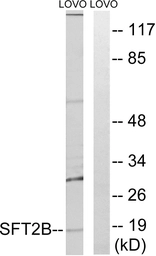 Anti-SFT2B antibody used in Western Blot (WB). GTX87795