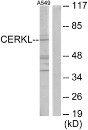Anti-CERKL antibody used in Western Blot (WB). GTX87803