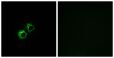 Anti-MRPS21 antibody used in Immunocytochemistry/ Immunofluorescence (ICC/IF). GTX87804