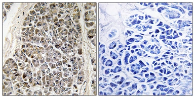 Anti-MRPS21 antibody used in IHC (Paraffin sections) (IHC-P). GTX87804