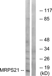 Anti-MRPS21 antibody used in Western Blot (WB). GTX87804