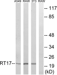 Anti-MRPS17 antibody used in Western Blot (WB). GTX87806