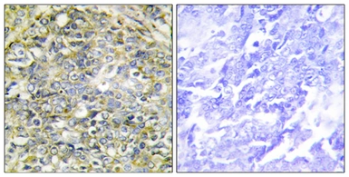 Anti-UBXD5 antibody used in IHC (Paraffin sections) (IHC-P). GTX87807