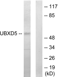 Anti-UBXD5 antibody used in Western Blot (WB). GTX87807