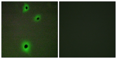 Anti-CADM4 antibody used in Immunocytochemistry/ Immunofluorescence (ICC/IF). GTX87808