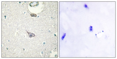 Anti-CADM4 antibody used in IHC (Paraffin sections) (IHC-P). GTX87808