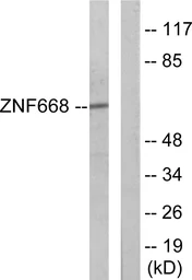 Anti-ZNF668 antibody used in Western Blot (WB). GTX87809