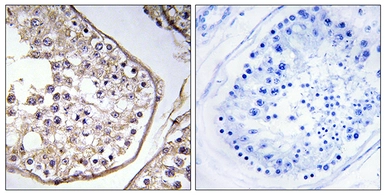 Anti-BAGE3 antibody used in IHC (Paraffin sections) (IHC-P). GTX87811