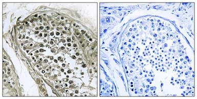 Anti-GAB4 antibody used in IHC (Paraffin sections) (IHC-P). GTX87813