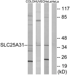 Anti-SLC25A31 antibody used in Western Blot (WB). GTX87816