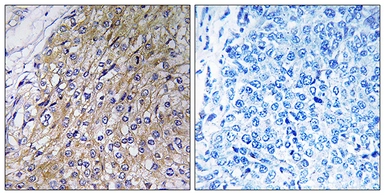 Anti-GOLT1A antibody used in IHC (Paraffin sections) (IHC-P). GTX87821