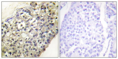 Anti-LATH antibody used in IHC (Paraffin sections) (IHC-P). GTX87824