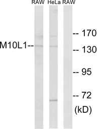 Anti-MOV10L1 antibody used in Western Blot (WB). GTX87827