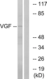Anti-VGF antibody used in Western Blot (WB). GTX87831