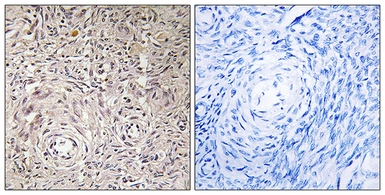 Anti-GCNT7 antibody used in IHC (Paraffin sections) (IHC-P). GTX87834