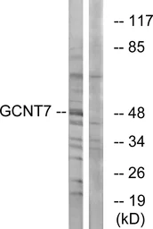 Anti-GCNT7 antibody used in Western Blot (WB). GTX87834