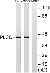 Anti-AGPAT4 antibody used in Western Blot (WB). GTX87835