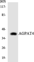 Anti-AGPAT4 antibody used in Western Blot (WB). GTX87835