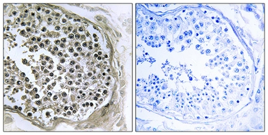 Anti-GIDRP88 antibody used in IHC (Paraffin sections) (IHC-P). GTX87836