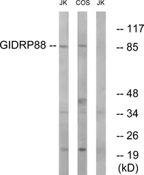 Anti-GIDRP88 antibody used in Western Blot (WB). GTX87836