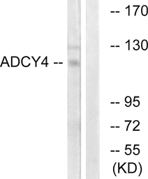 Anti-ADCY4 antibody used in Western Blot (WB). GTX87838