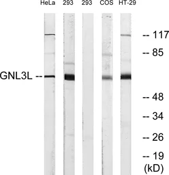 Anti-GNL3L antibody used in Western Blot (WB). GTX87842
