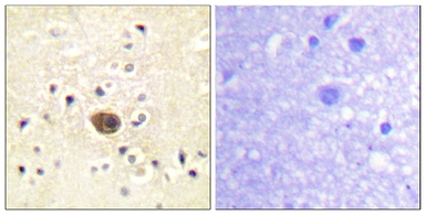 Anti-RASGRF1 antibody used in IHC (Paraffin sections) (IHC-P). GTX87849