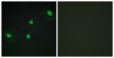 Anti-CDCA4 antibody used in Immunocytochemistry/ Immunofluorescence (ICC/IF). GTX87853