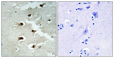 Anti-CDCA4 antibody used in IHC (Paraffin sections) (IHC-P). GTX87853