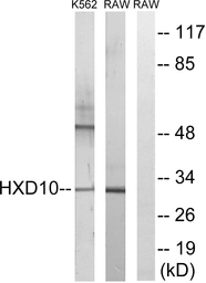 Anti-HOXD10 antibody used in Western Blot (WB). GTX87854